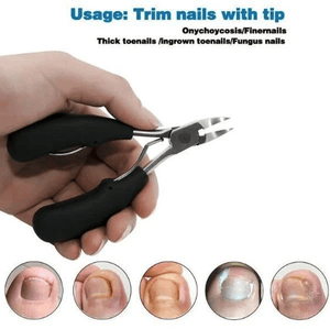 Medical-Grade Nail Clippers