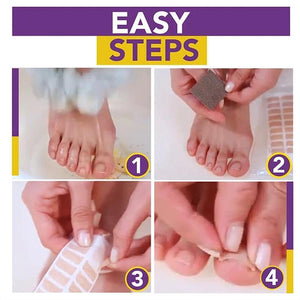 Non-Glue Toenail Patch