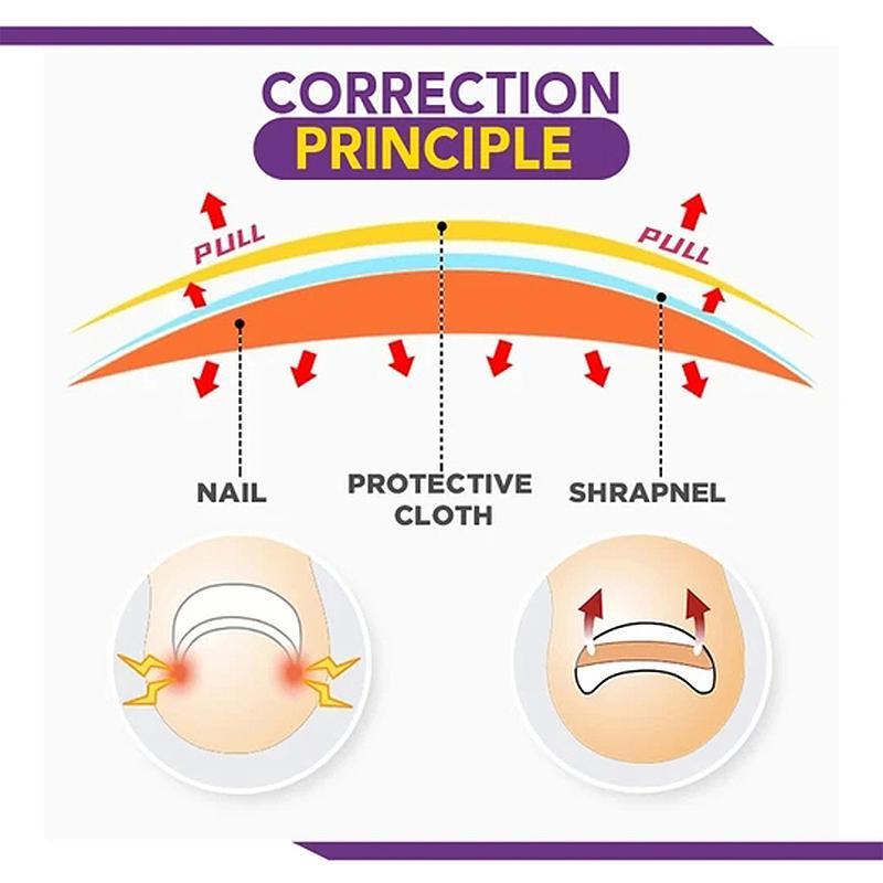 Non-Glue Toenail Patch